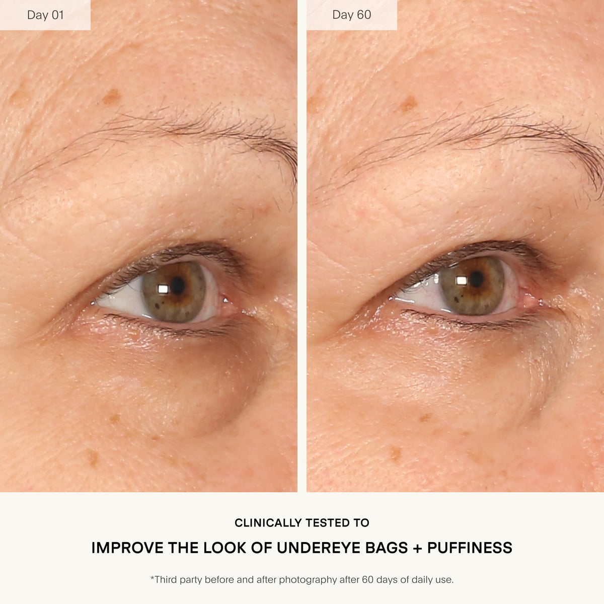 U Beauty application with fingertip demonstrating gentle patting for delicate eye area