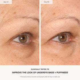 U Beauty application with fingertip demonstrating gentle patting for delicate eye area
