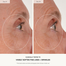 U Beauty capsule closeup showing SIREN capsule technology delivering active ingredients precisely
