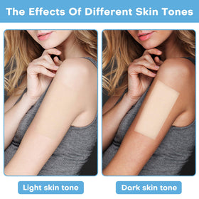 Udefineit light beige patch blending on skin to minimize shine and visibility
