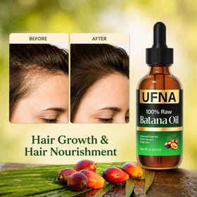 UFNA batana oil applied to scalp with fingertips improving scalp nourishment