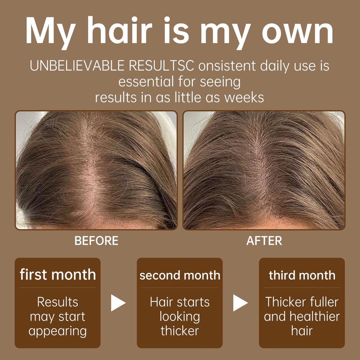 UIZELTA applied during scalp massage demonstrating stimulation benefit