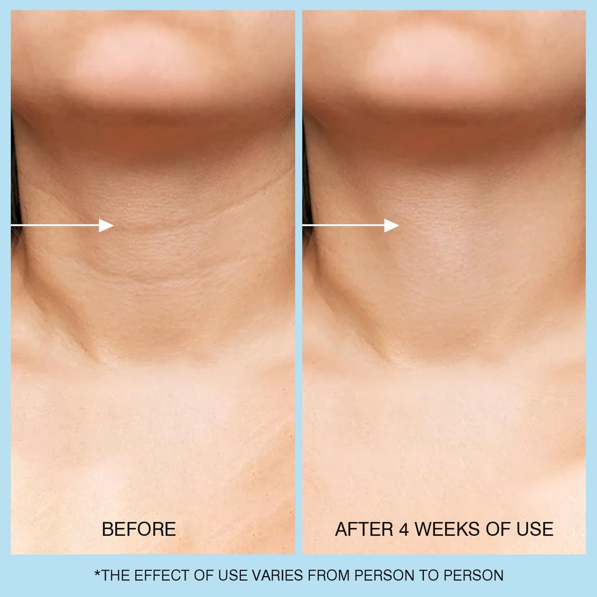 Close-up of retinol and hyaluronic acid ingredients in UJhay highlighting anti-aging benefits