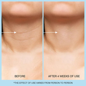 Close-up of retinol and hyaluronic acid ingredients in UJhay highlighting anti-aging benefits