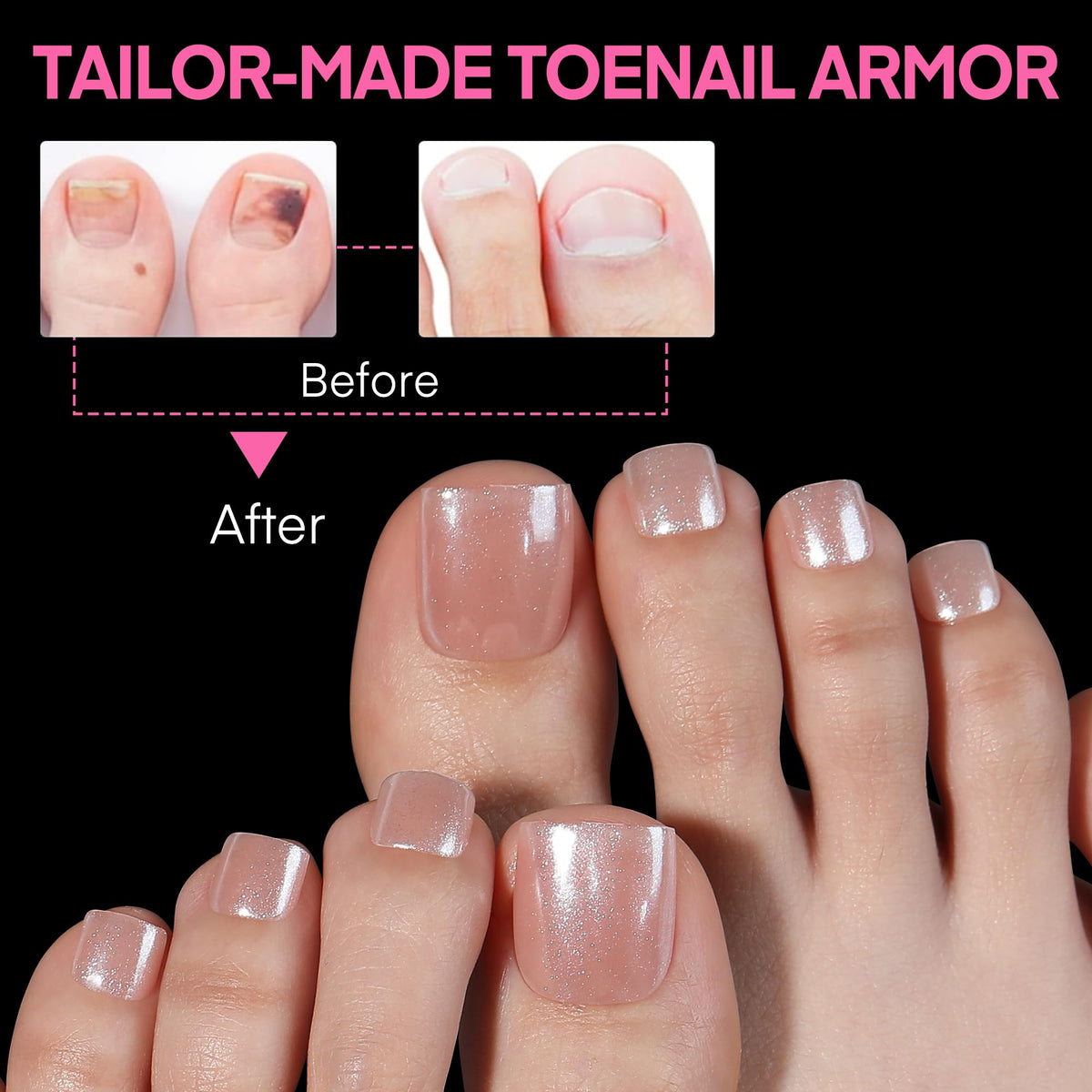 UNA GELLA lifestyle image in sandals demonstrating breathable, natural-looking toes