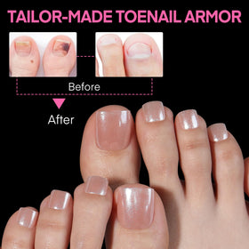 UNA GELLA lifestyle image in sandals demonstrating breathable, natural-looking toes