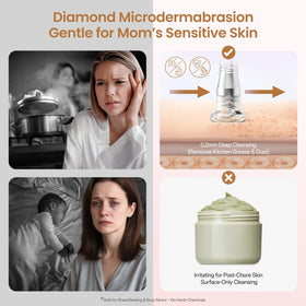 UNOISETION close-up of diamond heads highlighting precision exfoliation