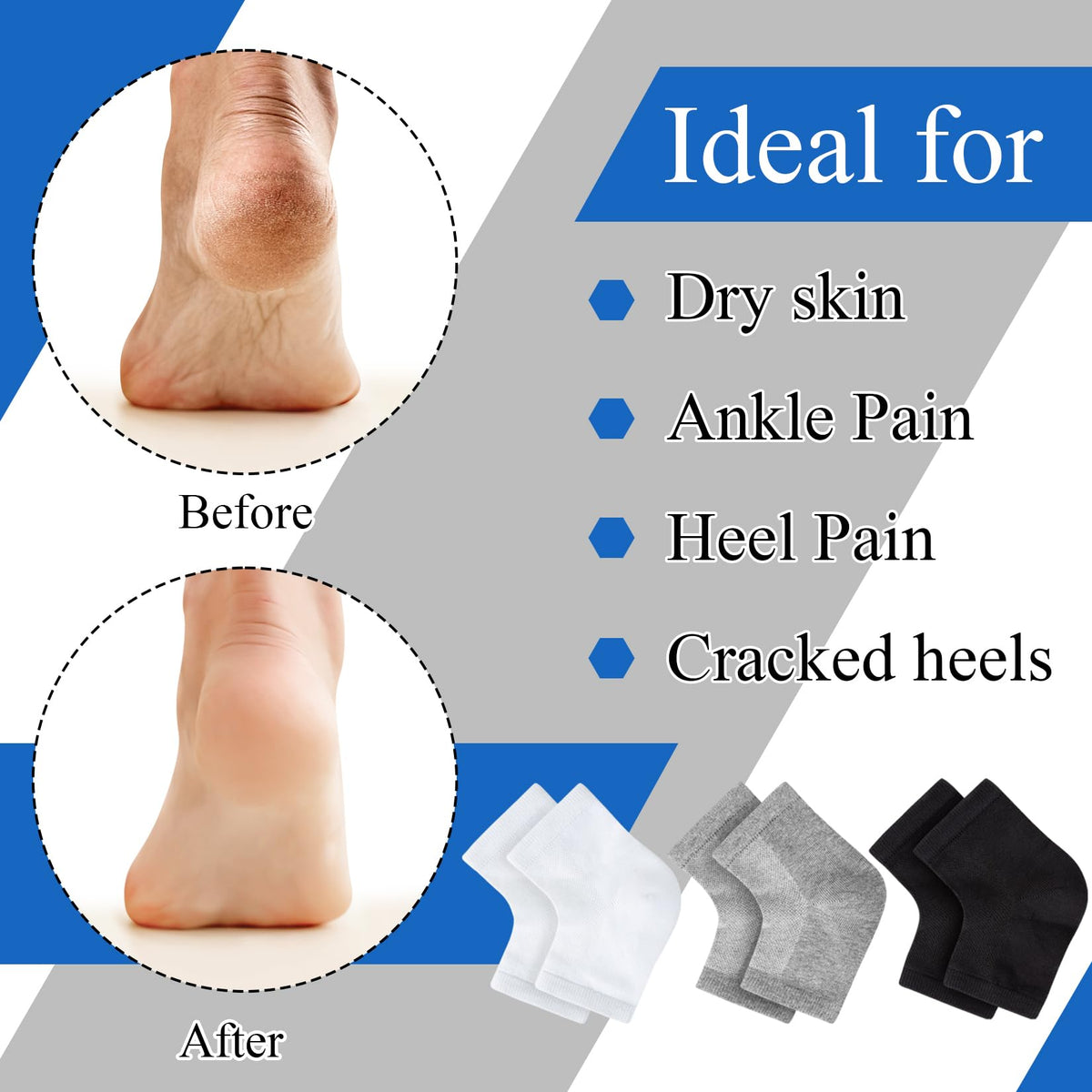 Unoutur open-toe sock detail showing breathable comfort and fit