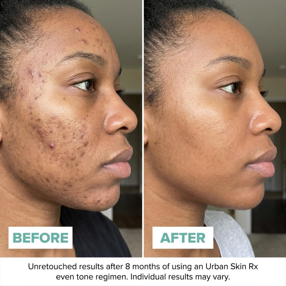 Urban Skin Rx applying cream to back of hand demonstrating quick absorption and glow