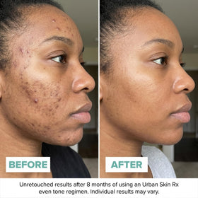 Urban Skin Rx applying cream to back of hand demonstrating quick absorption and glow