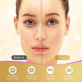 USTELIR patches applied under-eye on model demonstrating instant refresh