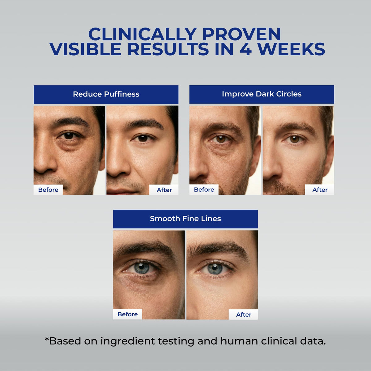 uttse applying cream under eye on male model to reduce puffiness and dark circles