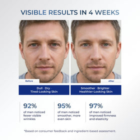 Uttse close-up ingredients label showing key actives like hyaluronic acid and peptides
