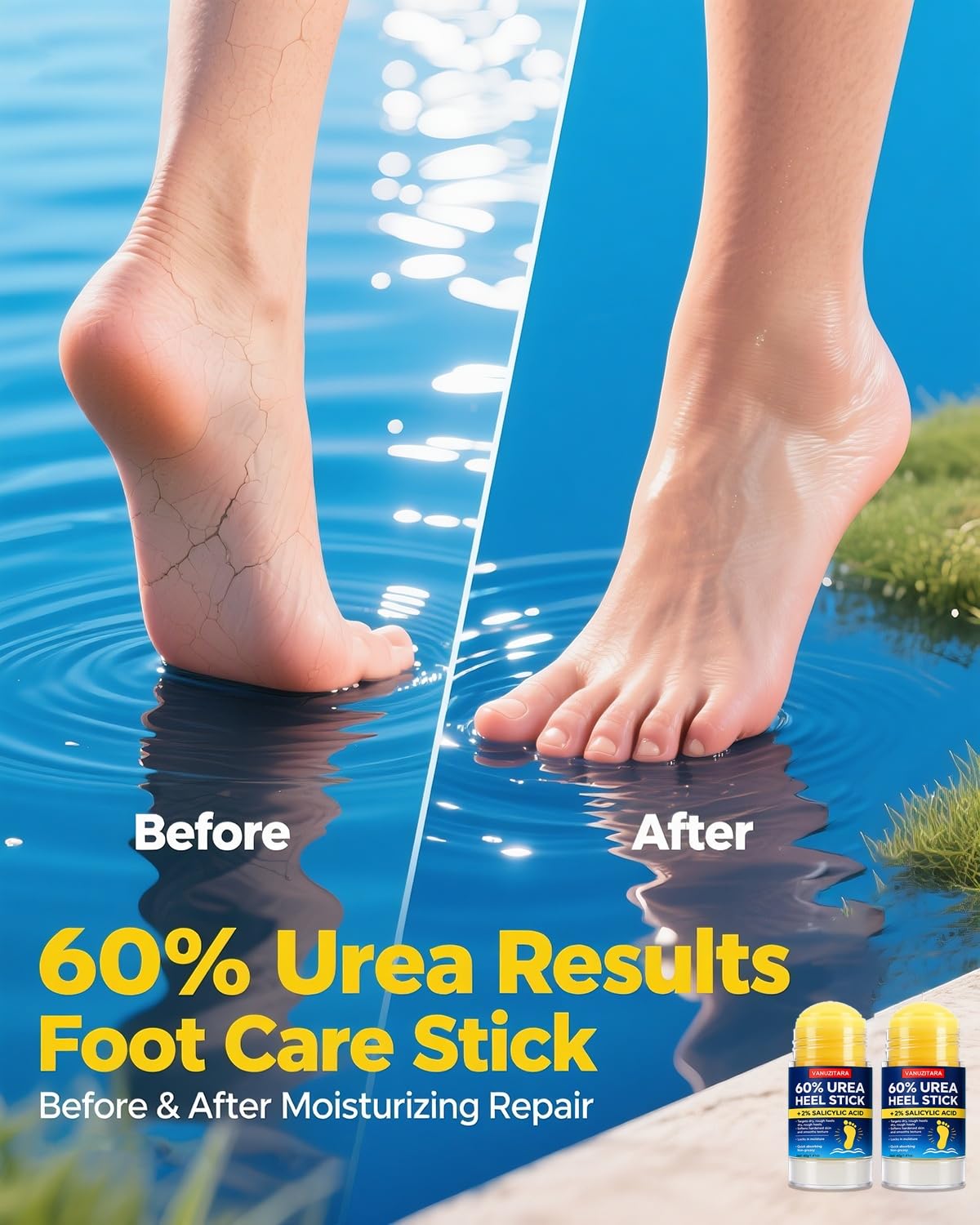 VANUZITARA applying stick to heel demonstrating targeted softening