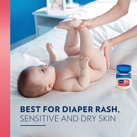 Vaseline applied to baby leg offering soothing moisture barrier