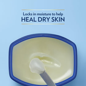 Vaseline on back of hand showing protective barrier and hydrated skin