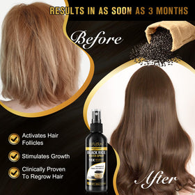 Vedora with ginger and castor oil ingredients showing natural support