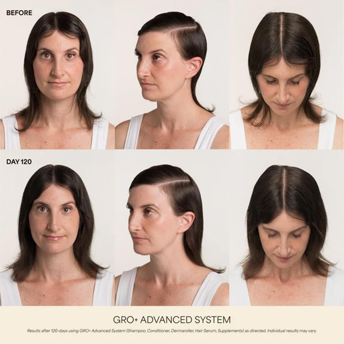 VEGAMOUR label close-up on GRO+ bottle showing dermatologist-collaborated formula