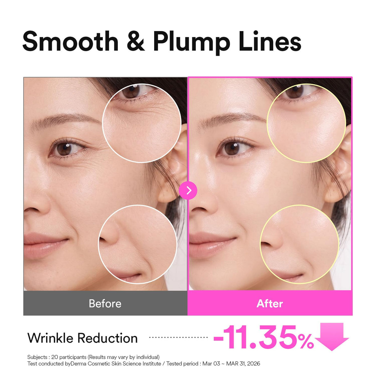 VERAFECT patch applied under eye demonstrating immediate soothing
