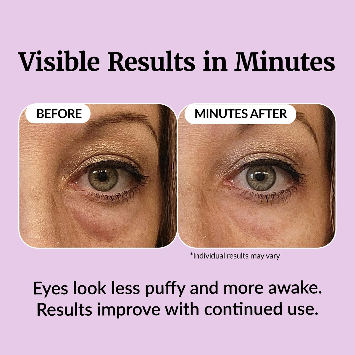 Vibriance before and after application comparison showing reduced puffiness