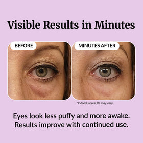 Vibriance before and after application comparison showing reduced puffiness