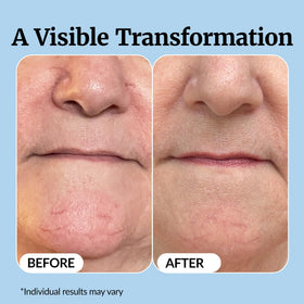 Vibriance serum on fingers displaying lightweight texture for easy application
