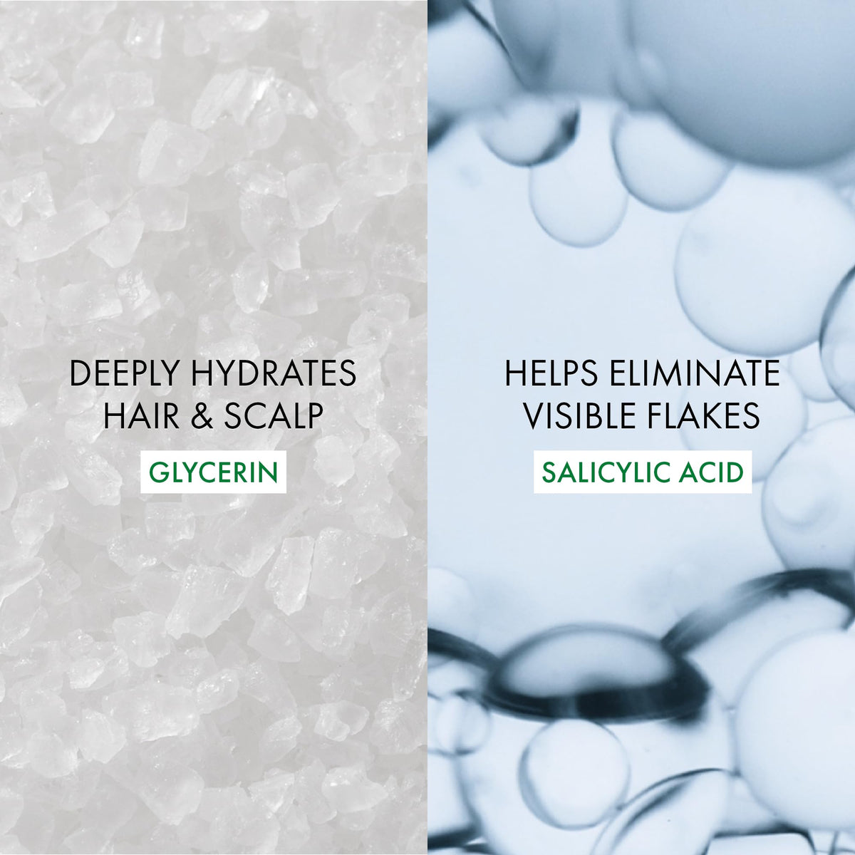 VICHY Dercos applied to curly hair showing even scalp coverage benefit