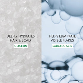 VICHY Dercos applied to curly hair showing even scalp coverage benefit