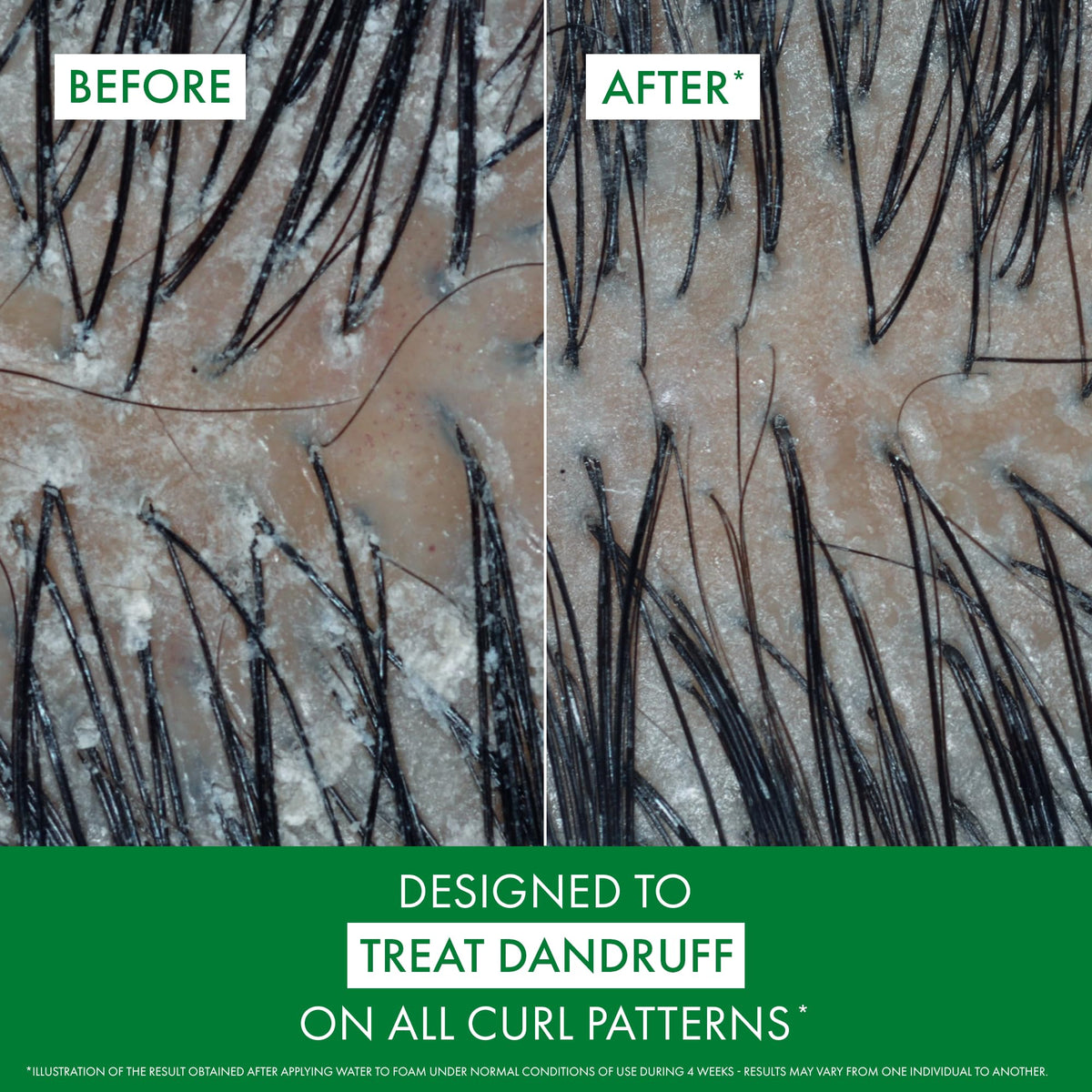 VICHY Dercos water-to-foam texture demonstrating scalp reach benefit