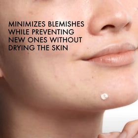 Vichy product being applied to a blemish, reducing redness and swelling