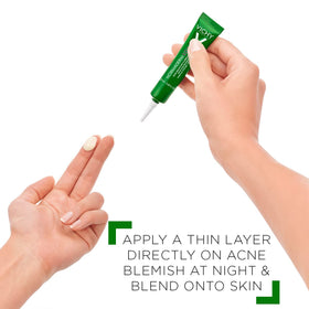 Vichy before and after spot results on skin, showing reduced blemish size
