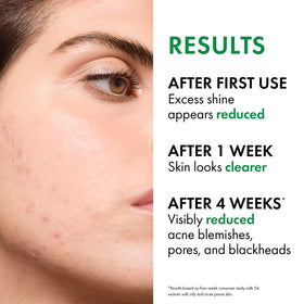 VICHY Normaderm foaming on skin to show gentle cleansing action