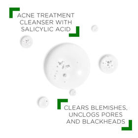 VICHY Normaderm gel texture on hand demonstrating gentle exfoliating benefit