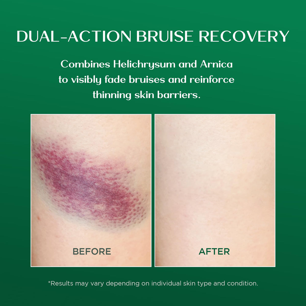 Vigority application on hand demonstrating quick absorption and comfort