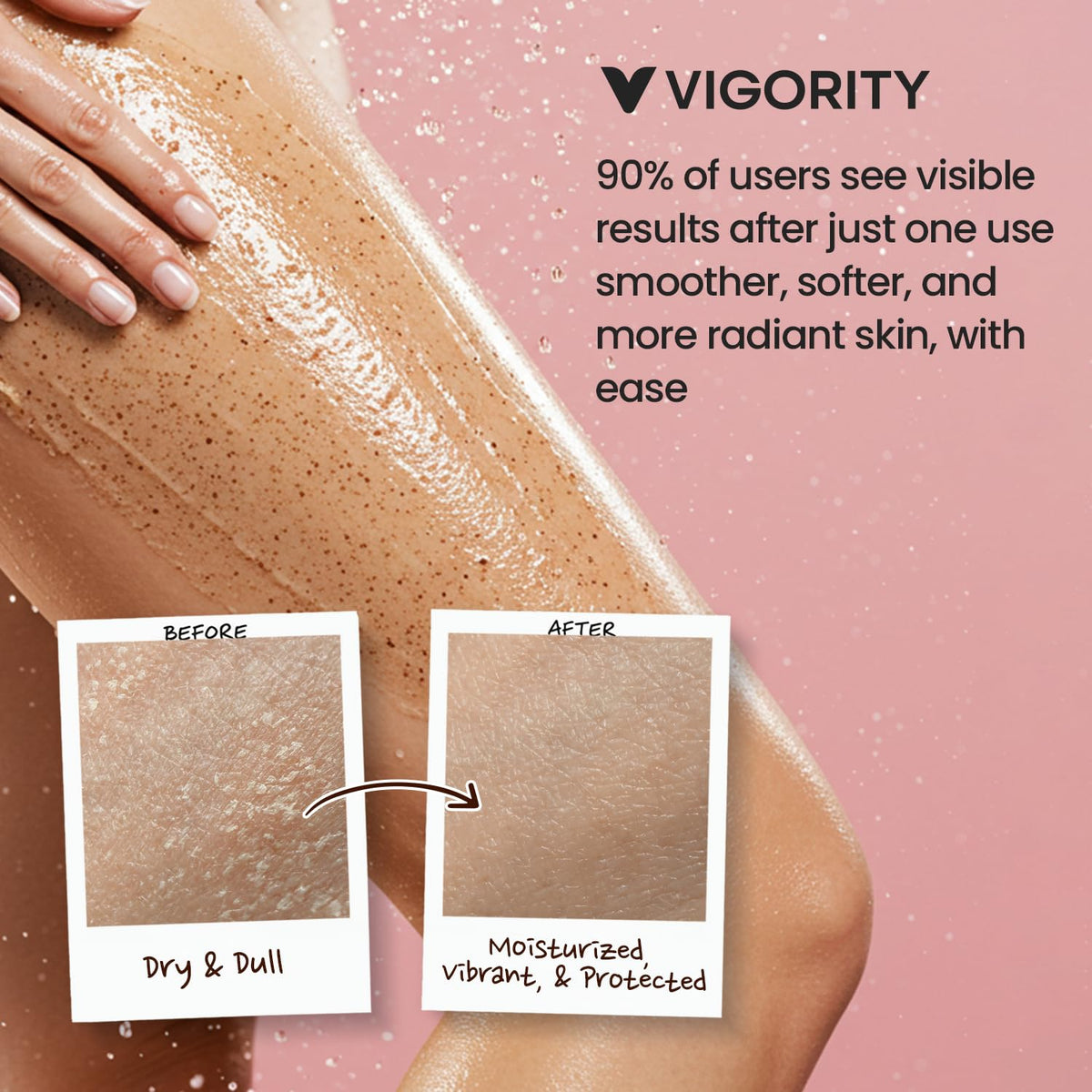 Vigority KP Bump Eraser before and after arms demonstrating smoother skin