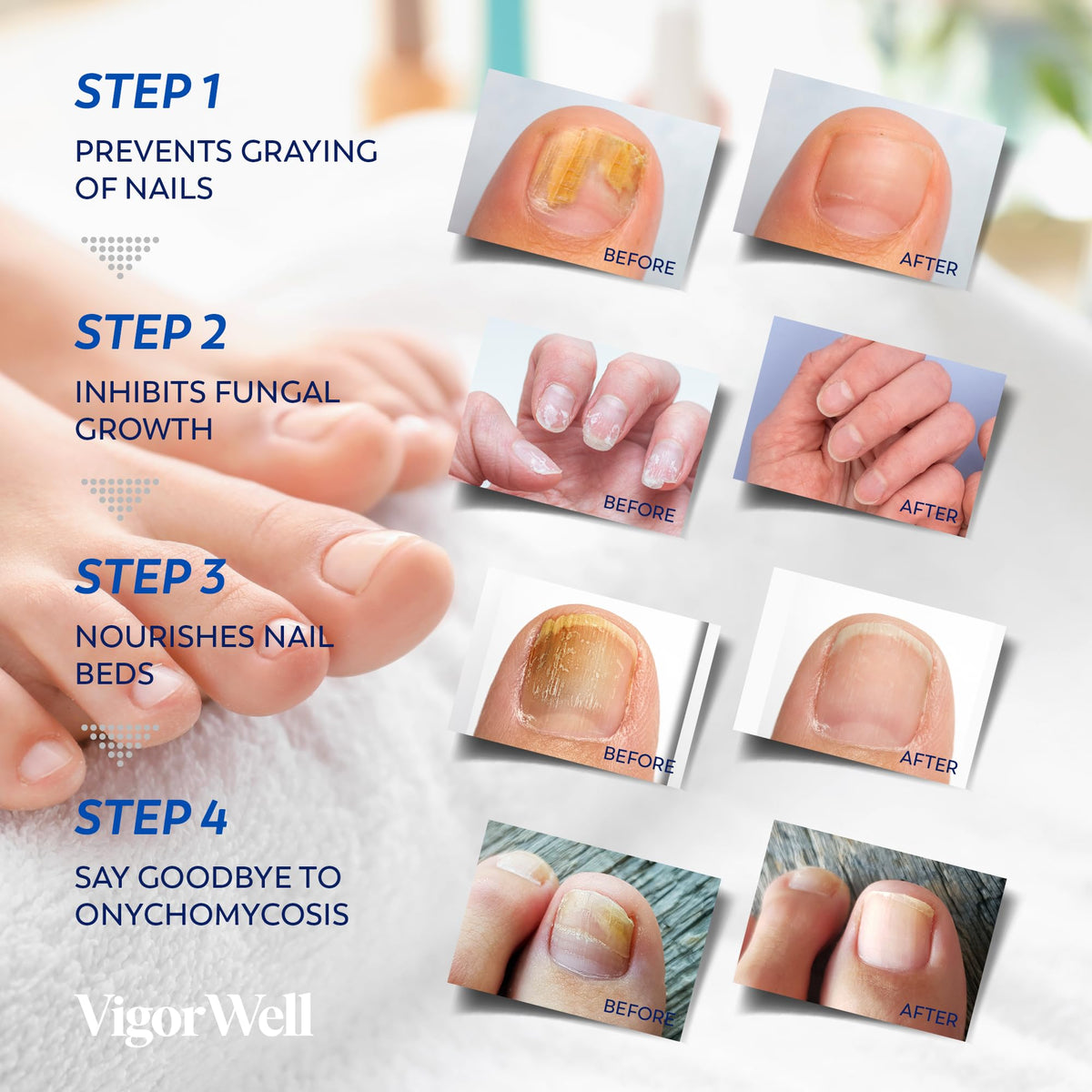 VigorWell patch on toenail showing overnight discreet wear benefit