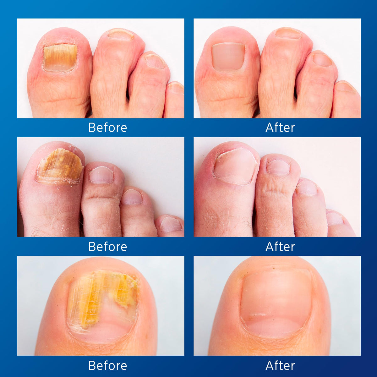 VigorWell sheet of 32 nighttime nail patches close-up demonstrating texture