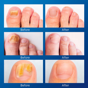 VigorWell sheet of 32 nighttime nail patches close-up demonstrating texture