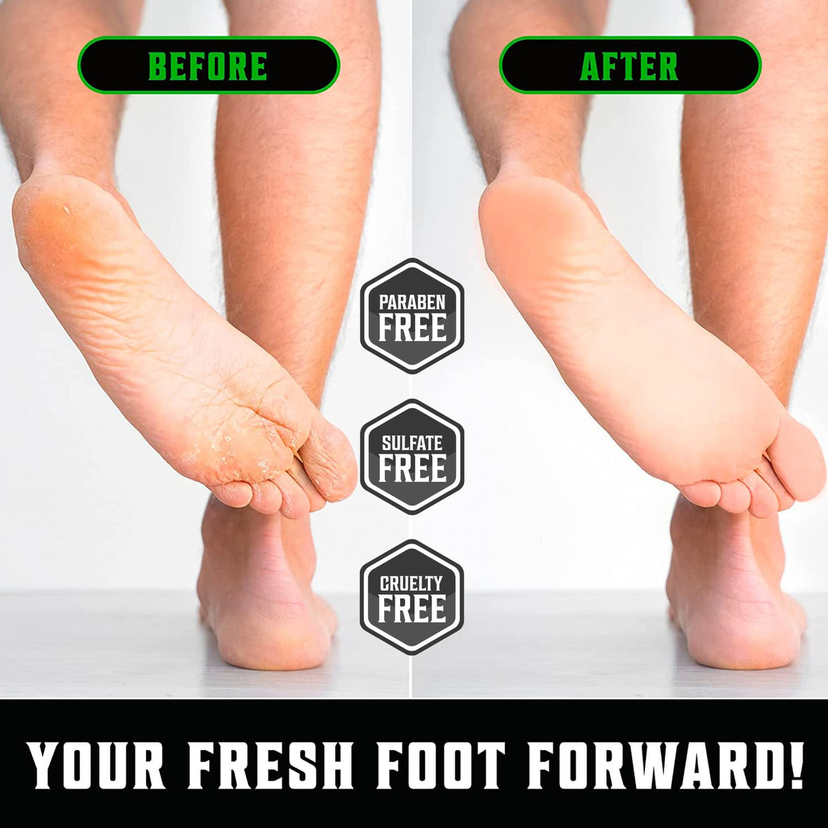 Viking Revolution being massaged into a heel to relieve dryness and cracking