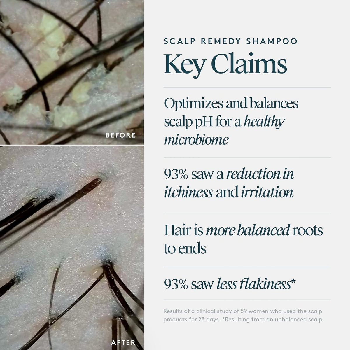 VIRTUE pump and label detail highlighting active Alpha Keratin 60ku Clinical for scalp support