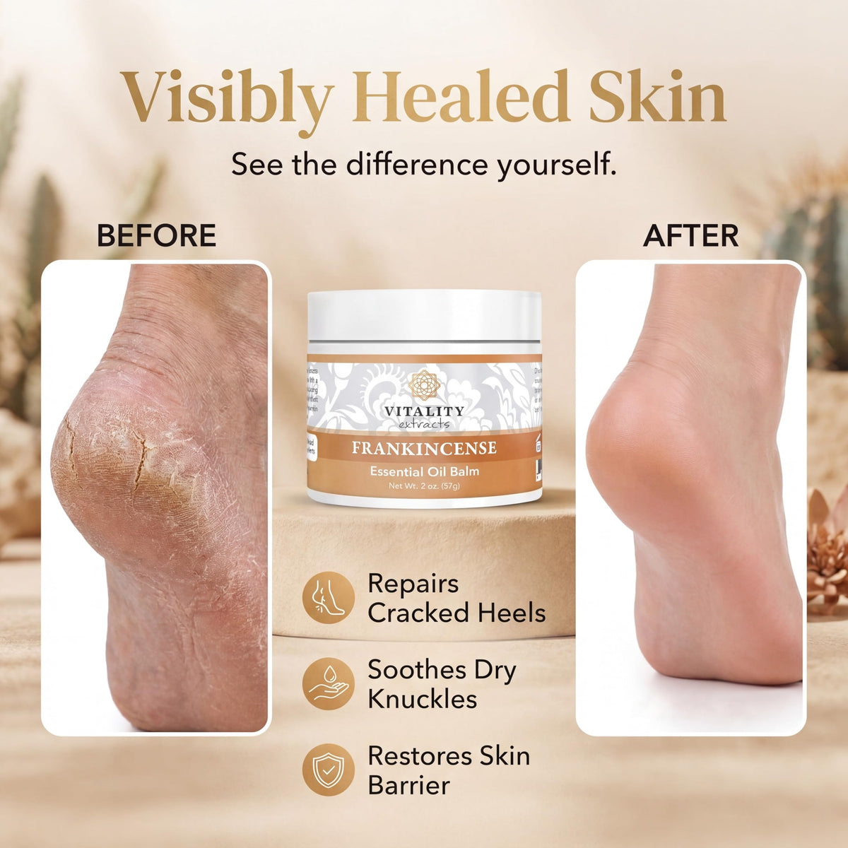 Vitality balm being massaged into hands to demonstrate moisturization and softness