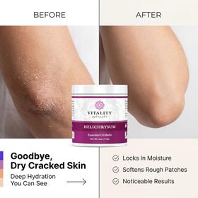 Vitality balm being applied to hands, demonstrates deep hydration and smooth finish