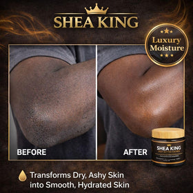 VITALSKINOIL open jar with visible ingredients highlighting natural butters for skin nourishment