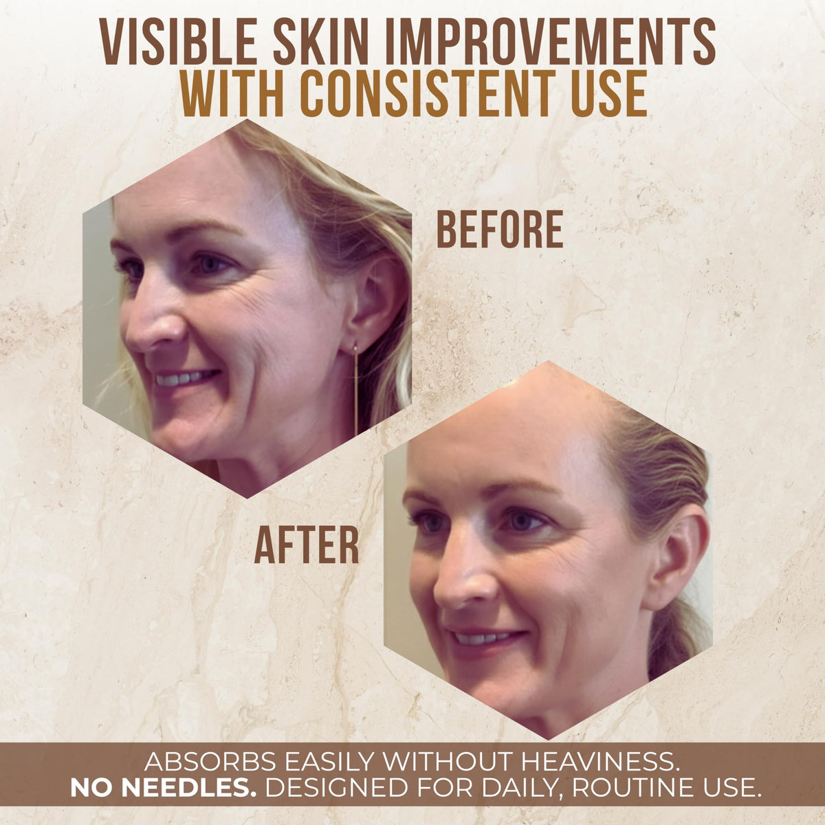 Vitamo cream applied to model cheek, demonstrates instant tightening effect