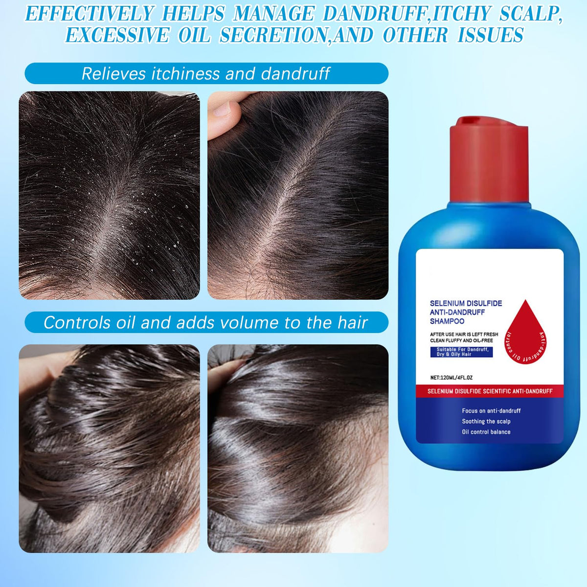 Viuvoiul Nipori being applied in shower showing scalp massage for improved flake removal