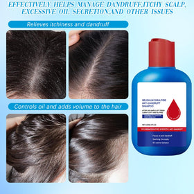 Viuvoiul Nipori being applied in shower showing scalp massage for improved flake removal