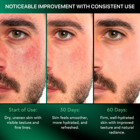 Viva Lab moisturizer texture on skin demonstrating non-greasy finish