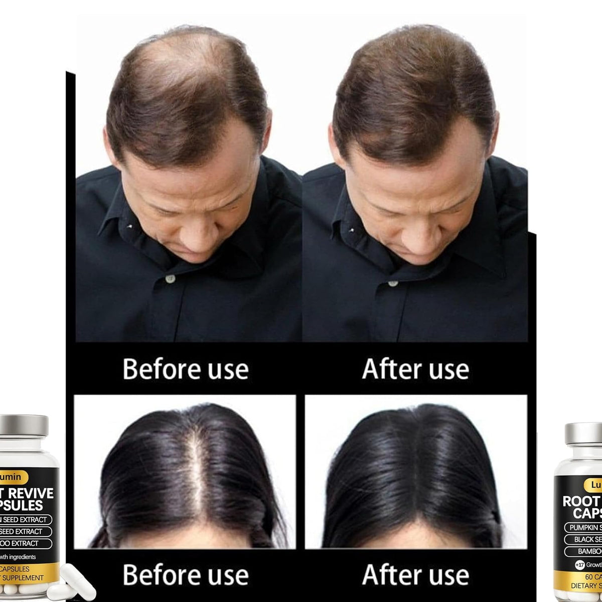 Vivikig capsule texture detail showing smooth capsule surface and easy swallow benefit