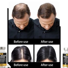 Vivikig capsule texture detail showing smooth capsule surface and easy swallow benefit