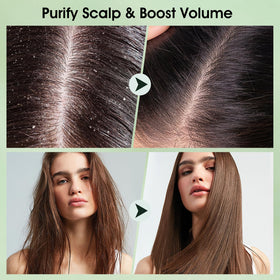 VOERUY being applied to wet hair roots demonstrating cleansing and soothing benefit